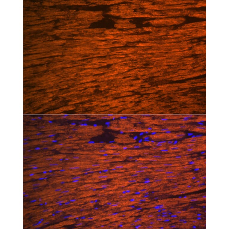 Immunofluorescence - Anti-Myosin Light Chain 2 Antibody (A88648) - Antibodies.com