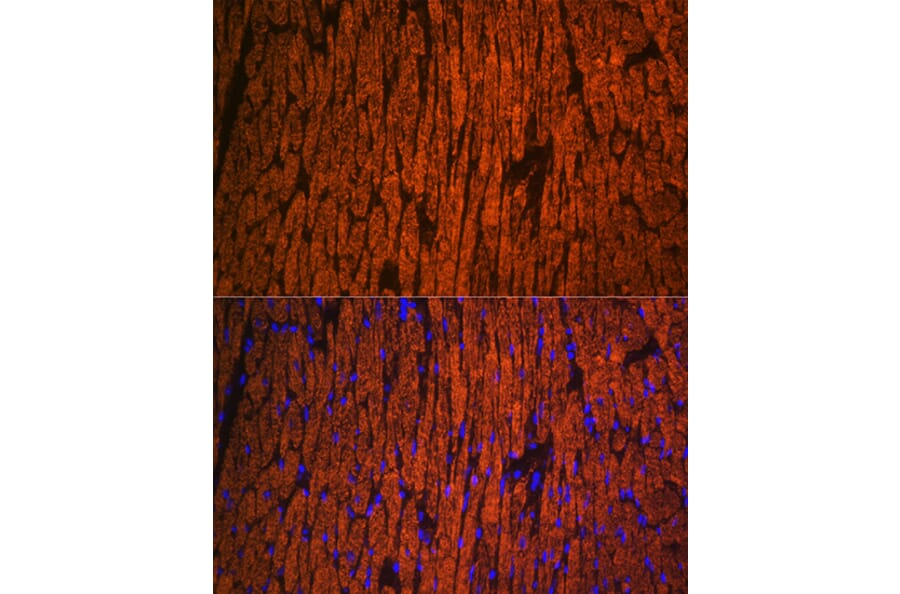 Immunofluorescence - Anti-Myosin Light Chain 2 Antibody (A88648) - Antibodies.com