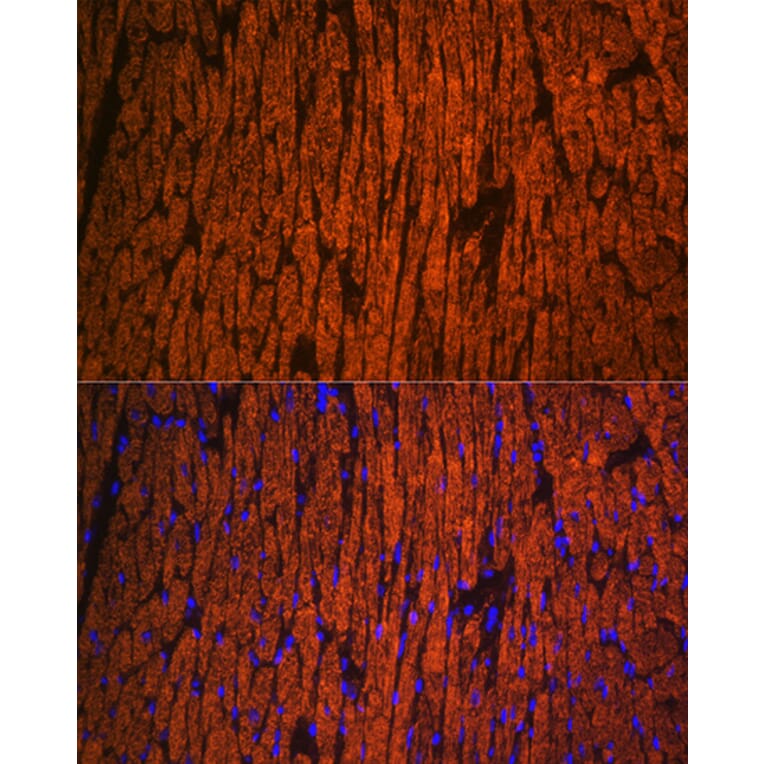 Immunofluorescence - Anti-Myosin Light Chain 2 Antibody (A88648) - Antibodies.com