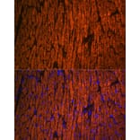 Immunofluorescence - Anti-Myosin Light Chain 2 Antibody (A88648) - Antibodies.com