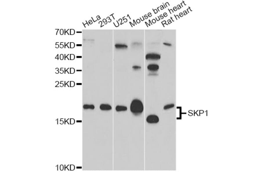Western Blot - Anti-SKP1 Antibody (A12518) - Antibodies.com