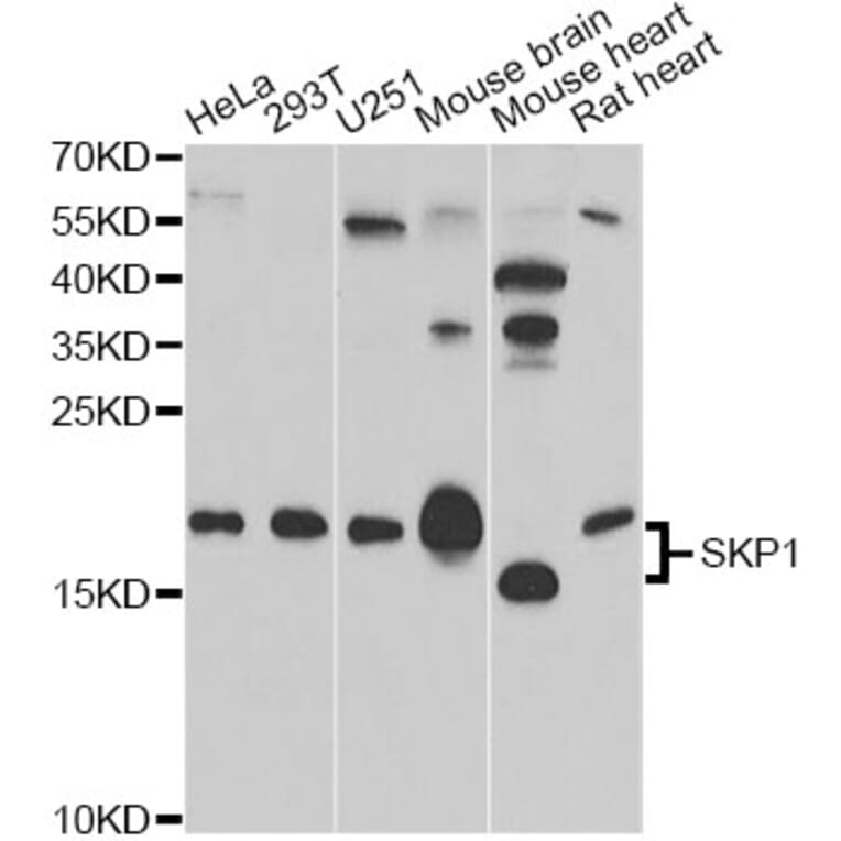 Western Blot - Anti-SKP1 Antibody (A12518) - Antibodies.com