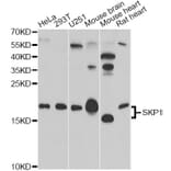 Western Blot - Anti-SKP1 Antibody (A12518) - Antibodies.com