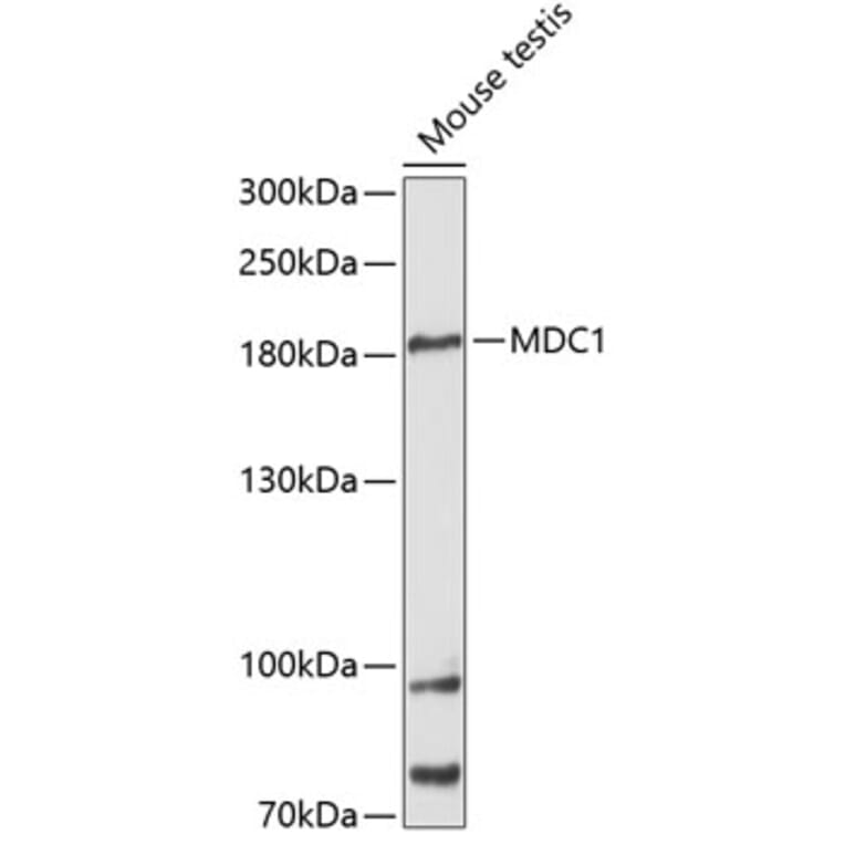 Western Blot - Anti-MDC1 Antibody (A88650) - Antibodies.com