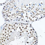 Immunohistochemistry - Anti-MDC1 Antibody (A88650) - Antibodies.com