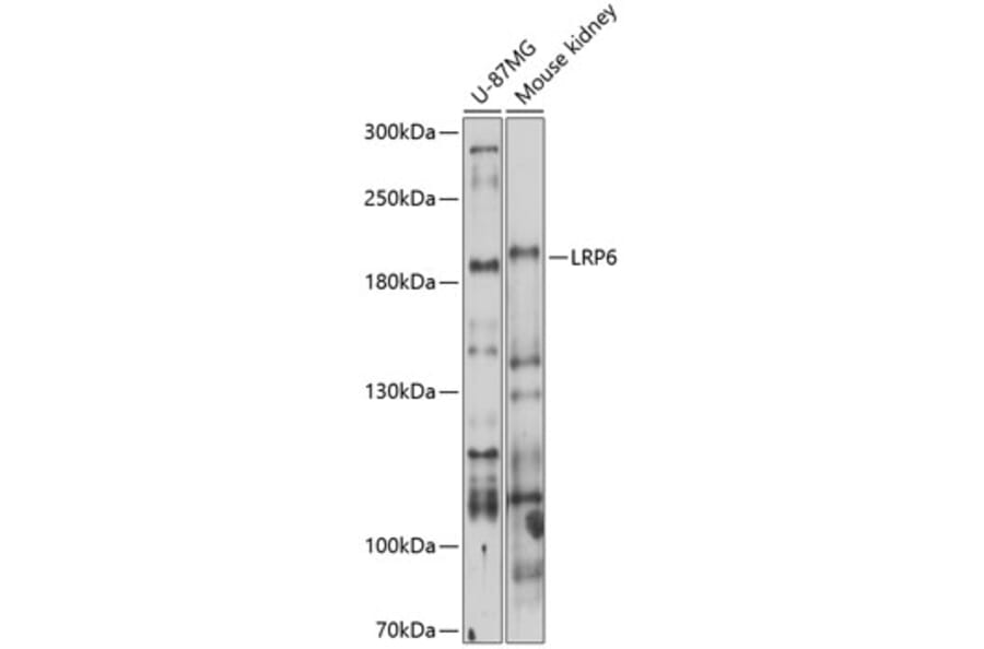Western Blot - Anti-LRP6 Antibody (A13678) - Antibodies.com