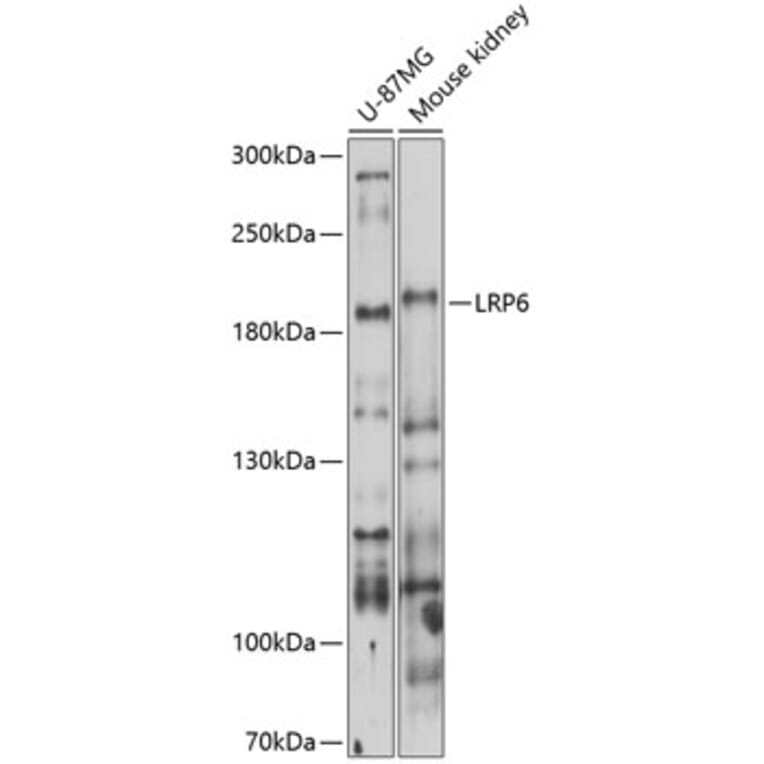 Western Blot - Anti-LRP6 Antibody (A13678) - Antibodies.com
