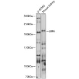 Western Blot - Anti-LRP6 Antibody (A13678) - Antibodies.com