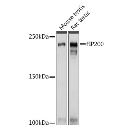Western Blot - Anti-FIP200 Antibody (A88652) - Antibodies.com