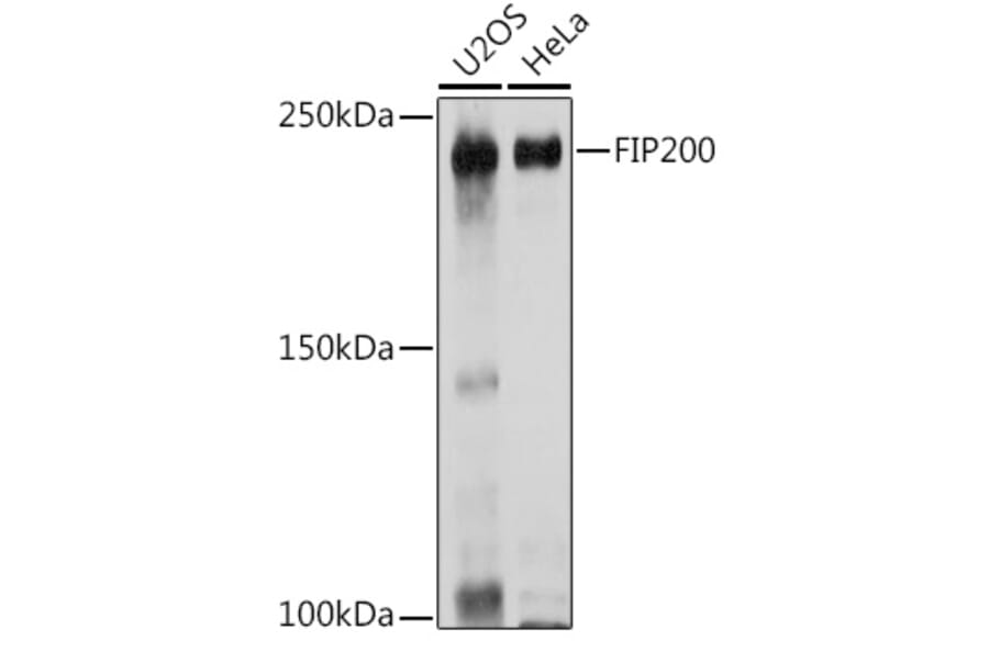 Western Blot - Anti-FIP200 Antibody (A88652) - Antibodies.com