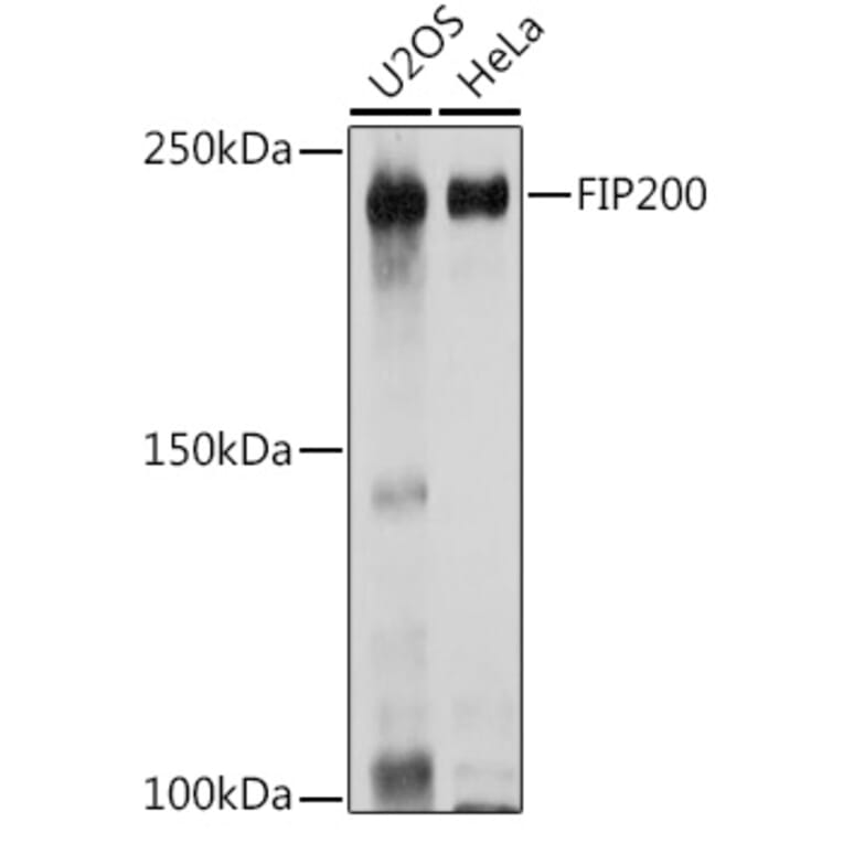 Western Blot - Anti-FIP200 Antibody (A88652) - Antibodies.com