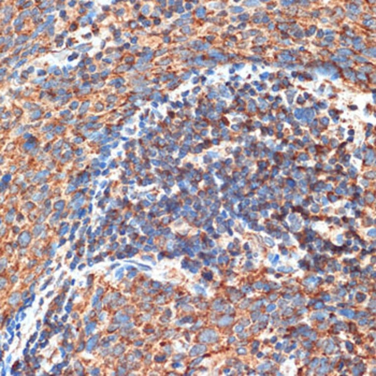 Immunohistochemistry - Anti-FIP200 Antibody (A88652) - Antibodies.com