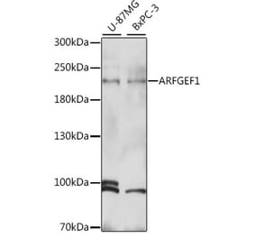 Western Blot - Anti-BIG1 Antibody (A88654) - Antibodies.com