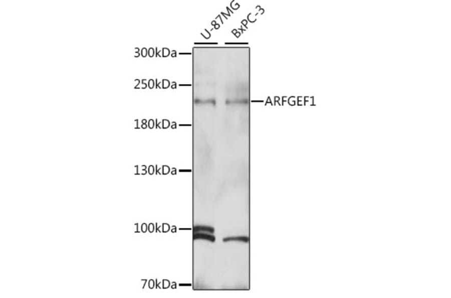 Western Blot - Anti-BIG1 Antibody (A88654) - Antibodies.com