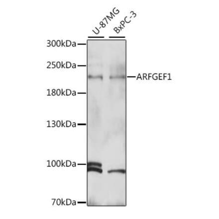 Western Blot - Anti-BIG1 Antibody (A88654) - Antibodies.com