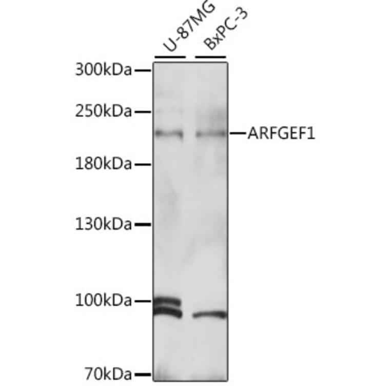 Western Blot - Anti-BIG1 Antibody (A88654) - Antibodies.com