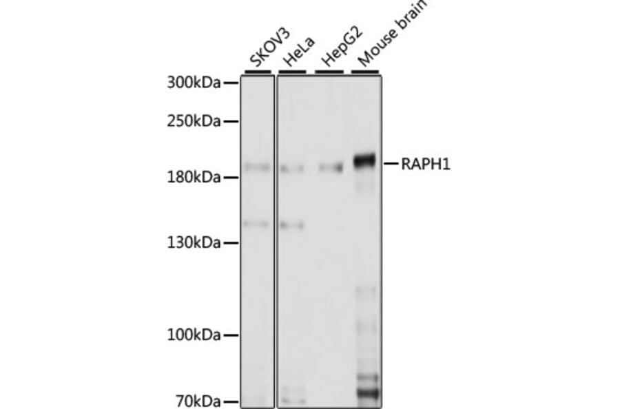 Western Blot - Anti-RAPH1 Antibody (A88655) - Antibodies.com
