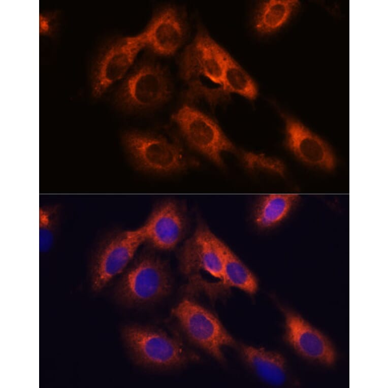 Immunofluorescence - Anti-RAPH1 Antibody (A88655) - Antibodies.com