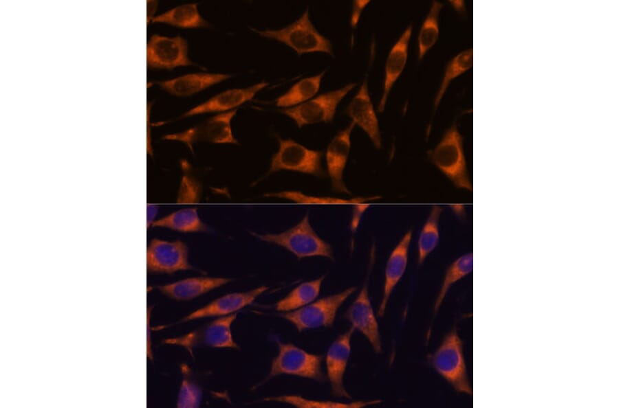 Immunofluorescence - Anti-RAPH1 Antibody (A88655) - Antibodies.com
