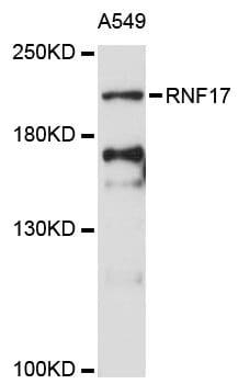 Western blot analysis of extracts of A-549 cells, using Anti-RNF17 Antibody (A13813) at 1:3000 dilution.
Secondary antibody: Goat Anti-Rabbit IgG (H+L) (HRP) (AS014) at 1:10,000 dilution.
Lysates / proteins: 25µg per lane.
Blocking buffer: 3% non-fat dry milk in TBST.
Detection: ECL Enhanced Kit (RM00021).
Exposure time: 90s.