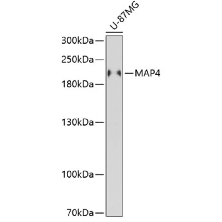 Western Blot - Anti-MAP4 Antibody (A88657) - Antibodies.com