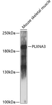 Western blot analysis of extracts of mouse skeletal muscle, using Anti-PLXNA3 Antibody (A14908) at 1:1,000 dilution.
Secondary antibody: Goat Anti-Rabbit IgG (H+L) (HRP) (AS014) at 1:10,000 dilution.
Lysates / proteins: 25µg per lane.
Blocking buffer: 3% non-fat dry milk in TBST.
Detection: ECL Basic Kit (RM00020).
Exposure time: 30s.