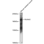 Western Blot - Anti-PLXNA3 Antibody (A88659) - Antibodies.com