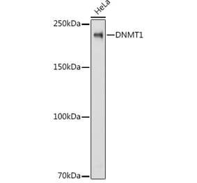 Western Blot - Anti-Dnmt1 Antibody (A88660) - Antibodies.com