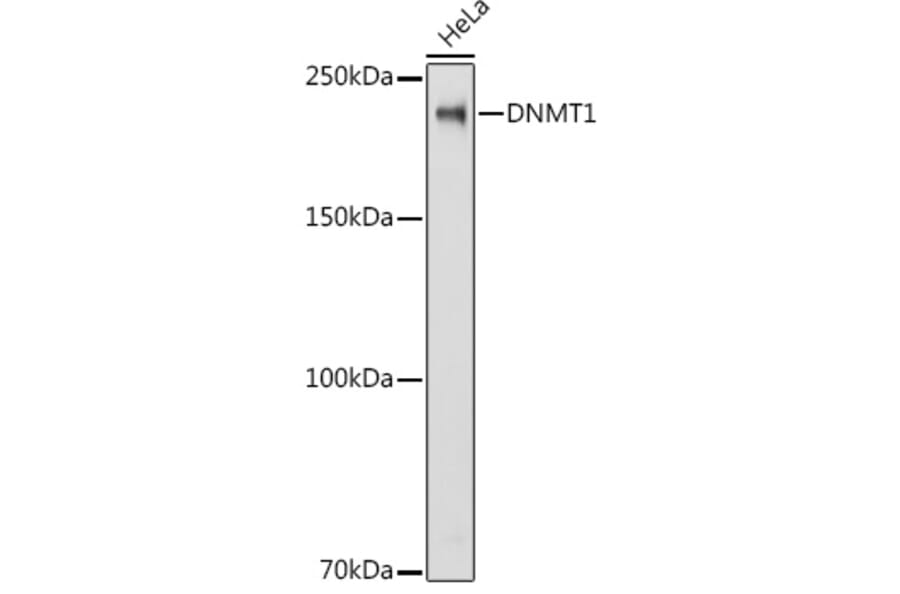 Western Blot - Anti-Dnmt1 Antibody (A88660) - Antibodies.com