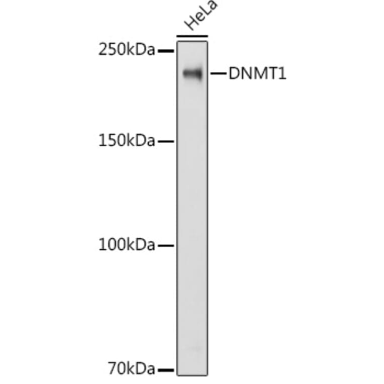 Western Blot - Anti-Dnmt1 Antibody (A88660) - Antibodies.com