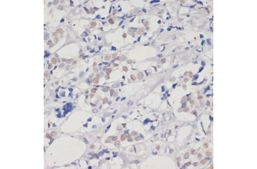 Immunohistochemistry - Anti-Dnmt1 Antibody (A88660) - Antibodies.com