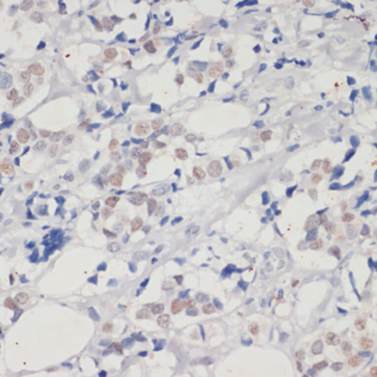 Immunohistochemistry - Anti-Dnmt1 Antibody (A88660) - Antibodies.com