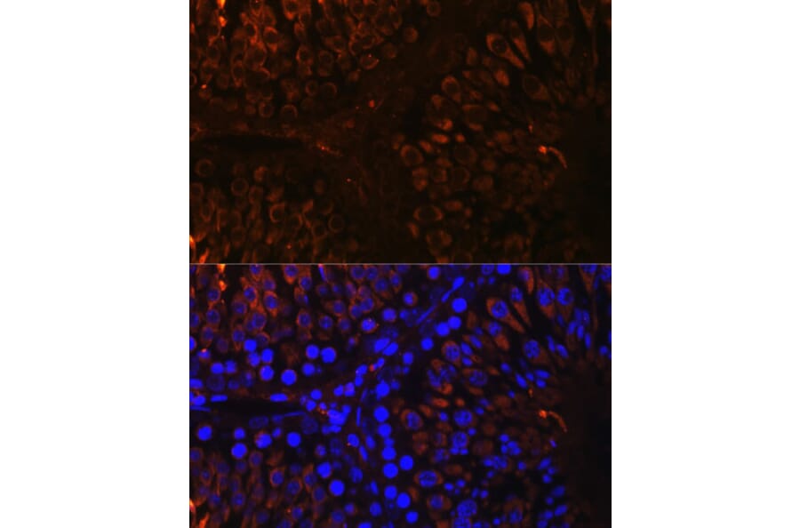 Immunofluorescence - Anti-Nogo Antibody (A88661) - Antibodies.com