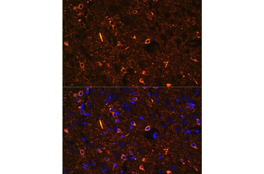 Immunofluorescence - Anti-Nogo Antibody (A88661) - Antibodies.com