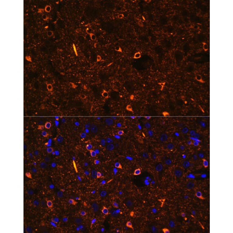 Immunofluorescence - Anti-Nogo Antibody (A88661) - Antibodies.com