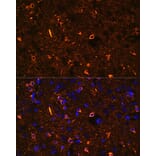 Immunofluorescence - Anti-Nogo Antibody (A88661) - Antibodies.com