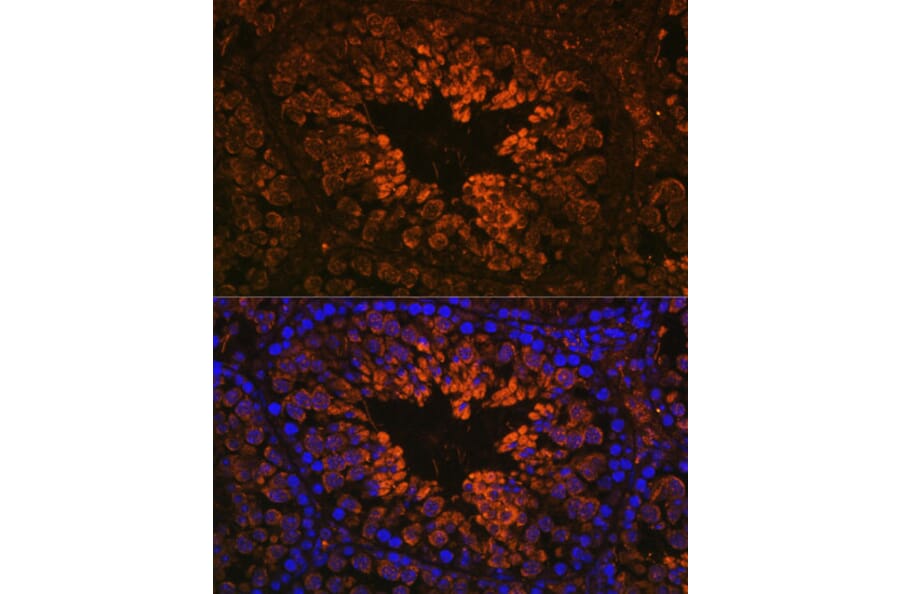 Immunofluorescence - Anti-Nogo Antibody (A88661) - Antibodies.com