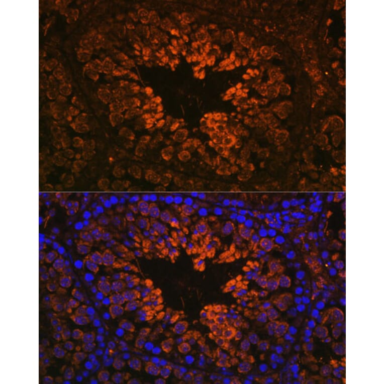 Immunofluorescence - Anti-Nogo Antibody (A88661) - Antibodies.com