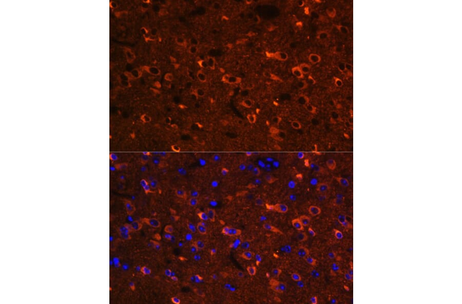 Immunofluorescence - Anti-Nogo Antibody (A88661) - Antibodies.com