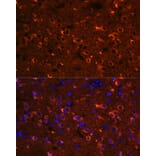 Immunofluorescence - Anti-Nogo Antibody (A88661) - Antibodies.com