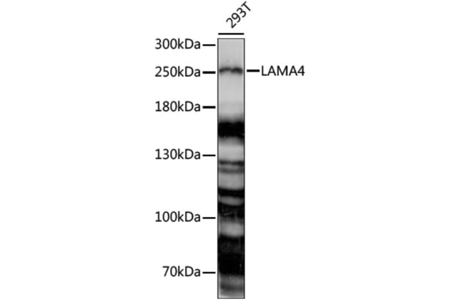 Western Blot - Anti-Laminin alpha 4/LAMA4 Antibody (A88663) - Antibodies.com