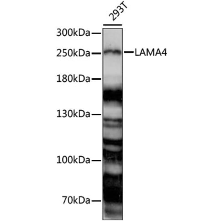 Western Blot - Anti-Laminin alpha 4/LAMA4 Antibody (A88663) - Antibodies.com