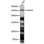 Western Blot - Anti-Laminin alpha 4/LAMA4 Antibody (A88663) - Antibodies.com
