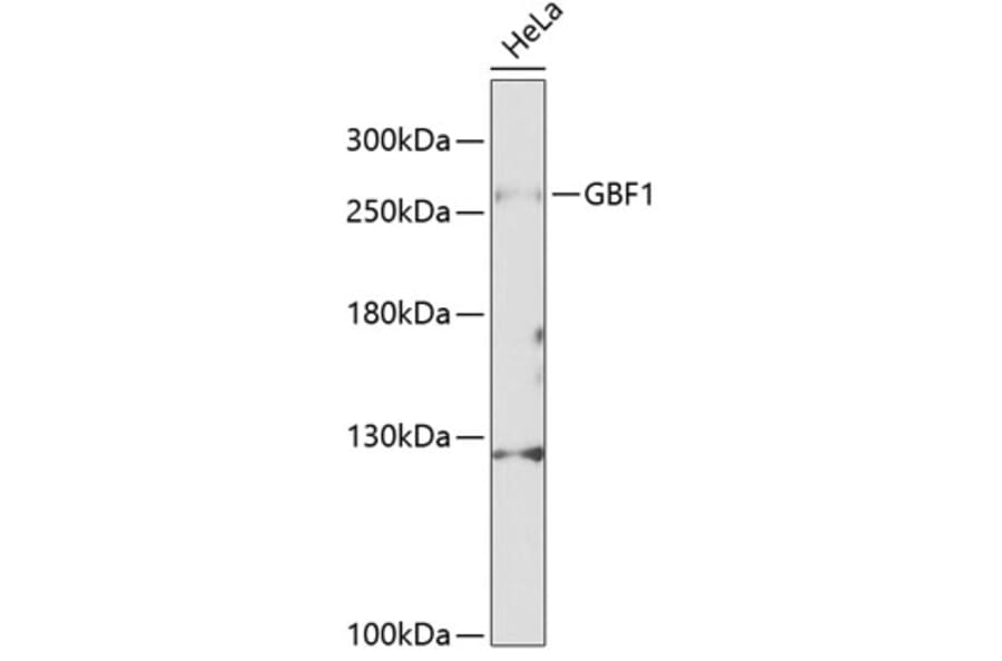 Western Blot - Anti-GBF1 Antibody (A88665) - Antibodies.com