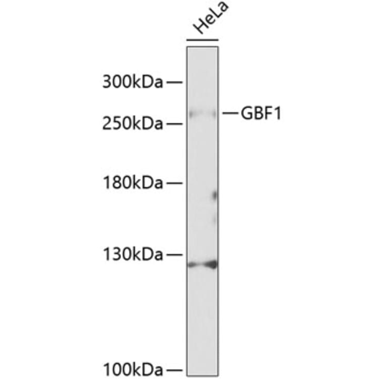 Western Blot - Anti-GBF1 Antibody (A88665) - Antibodies.com