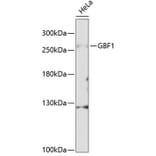 Western Blot - Anti-GBF1 Antibody (A88665) - Antibodies.com