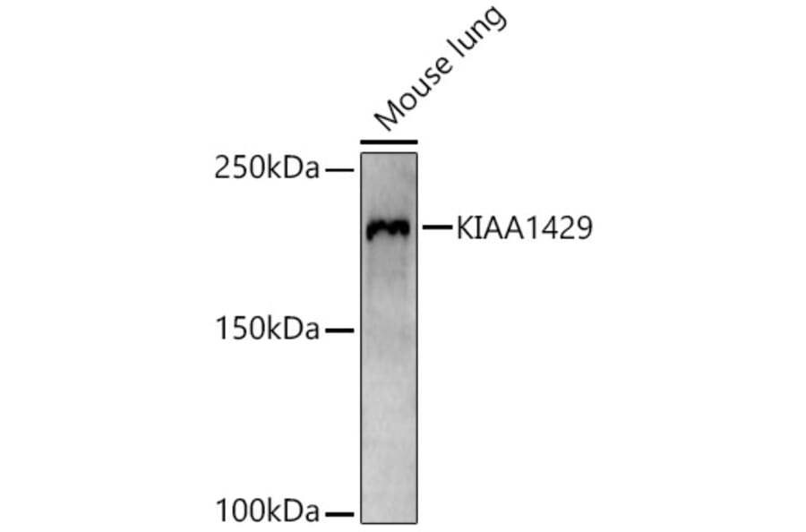 Western Blot - Anti-VIRMA/KIAA1429 Antibody (A88666) - Antibodies.com