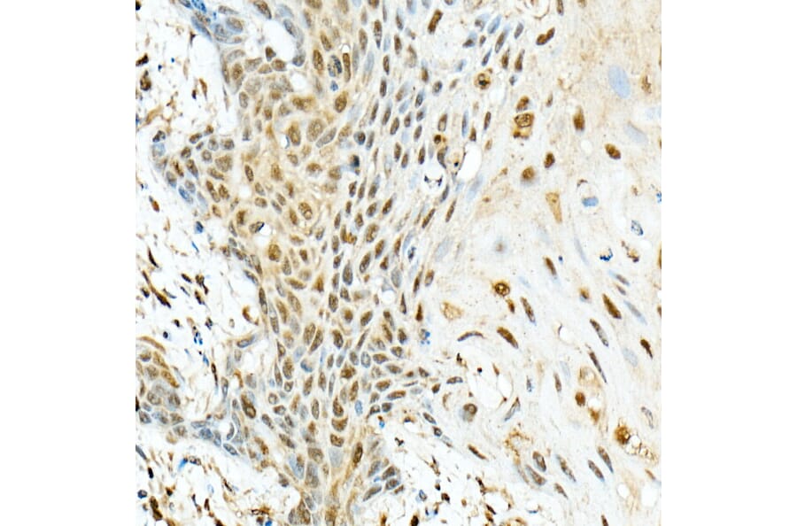 Immunohistochemistry - Anti-VIRMA/KIAA1429 Antibody (A88666) - Antibodies.com