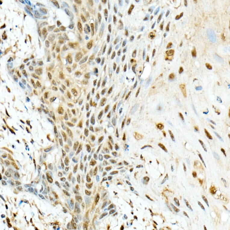 Immunohistochemistry - Anti-VIRMA/KIAA1429 Antibody (A88666) - Antibodies.com