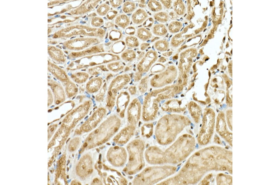 Immunohistochemistry - Anti-VIRMA/KIAA1429 Antibody (A88666) - Antibodies.com